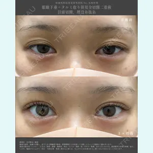 湘南美容クリニック 名古屋栄院の症例