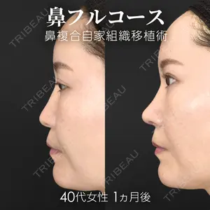 ジョウクリニック 銀座院 重本　譲医師の症例