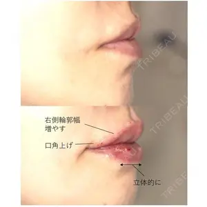 日比谷公園前歯科医院 乙丸 知映医師の症例
