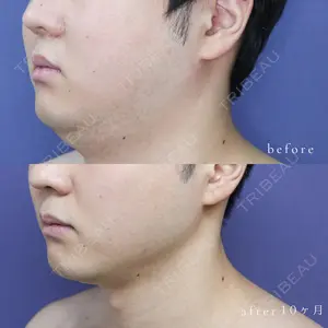 ガーデンクリニック 船橋院の症例