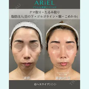 アリエル美容クリニック 大宮院 鈴木　桂介医師の症例