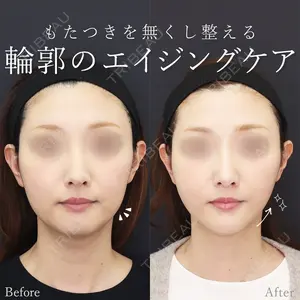 札幌TAクリニック 市丸 千聖医師の症例