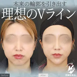 症例