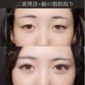 症例