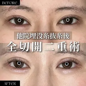 パーソナルビューティークリニック東京 【PBC TOKYO 銀座店】 森田 裕紀医師の症例