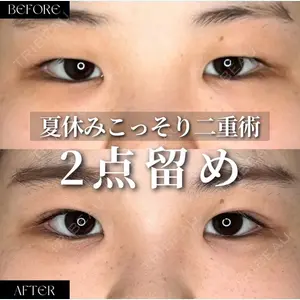 パーソナルビューティークリニック東京 【PBC TOKYO 銀座店】の症例