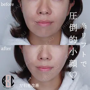 症例