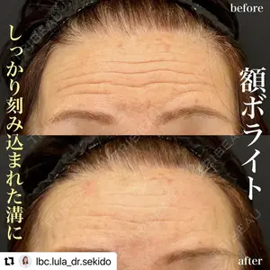 ルラ美容クリニック 名古屋栄院 関戸 優医師の症例