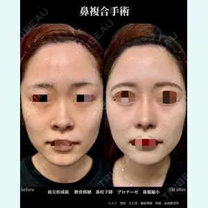 グローバルビューティークリニック 大阪院の症例