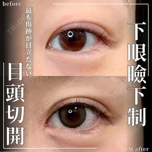 グローバルビューティークリニック 大阪院の症例