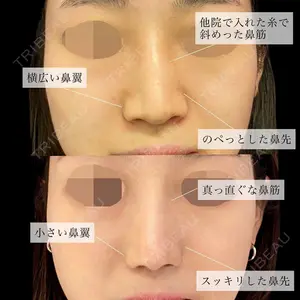 グローバルビューティークリニック 銀座院 理事長　杉崎　裕斗医師の症例