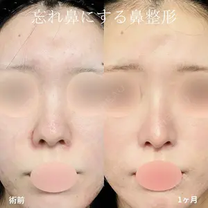 グローバルビューティークリニック 大阪院の症例