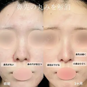 グローバルビューティークリニック 大阪院の症例