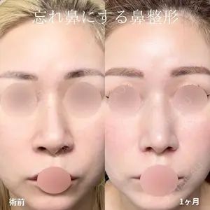 グローバルビューティークリニック 大阪院 大阪院院長 羽根和秀医師の症例