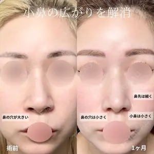 グローバルビューティークリニック 大阪院 大阪院院長 羽根和秀医師の症例