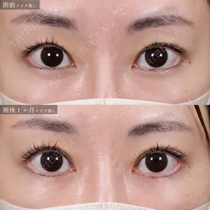 症例