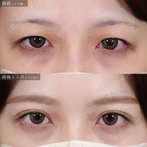 症例