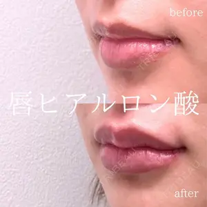 症例