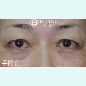 B-LINE CLINIC 池袋院 小池 康弘医師の症例