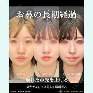 シンデレラ＆ダヴィンチクリニック 宮田 洋佑医師の症例