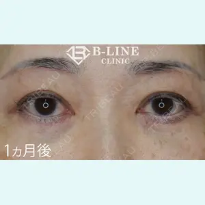 B-LINE CLINIC 池袋院 小池 康弘医師の症例