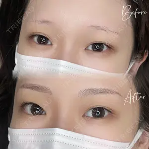 症例