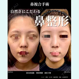 グローバルビューティークリニック 大阪院の症例