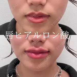 症例
