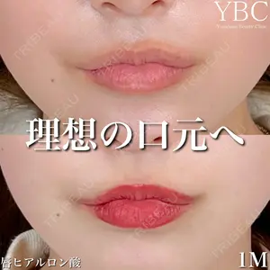 YBC横浜美容外科 大宮院 磯村 亮輔医師の症例