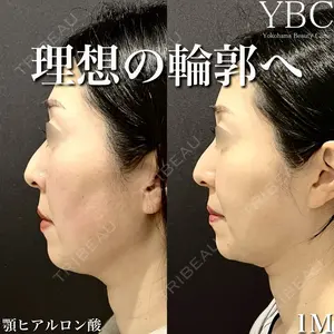 YBC横浜美容外科 大宮院 磯村 亮輔医師の症例