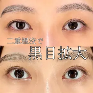 BIANCA銀座 明石 仙姫医師の症例