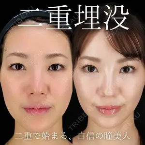 BIANCA銀座 明石 仙姫医師の症例