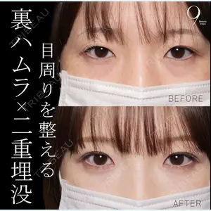 症例