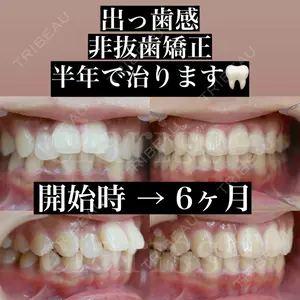 症例