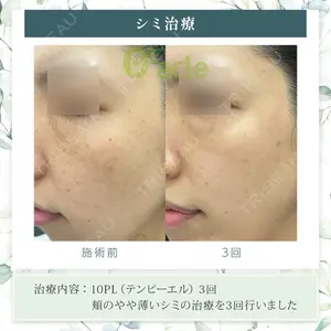 オラクル美容皮膚科 東京新宿院の症例
