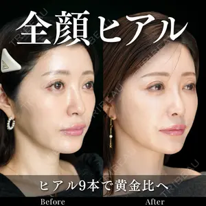 ルラ美容クリニック 池袋院 小海 元医師の症例