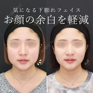 症例