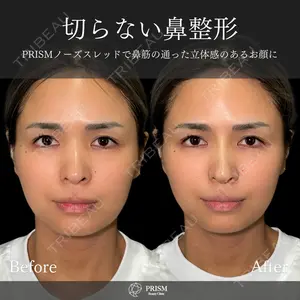 PRISM Beauty Clinic 畑山 知輝医師の症例