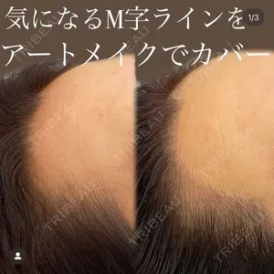 GRACIA clinic 【グラシアクリニック】 吉澤華純医師の症例