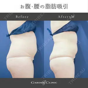 ガーデンクリニック 池袋院の症例