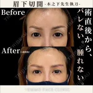 EMMO FACE CLINIC 東京三田院 木之下 哲彦医師の症例