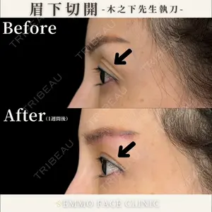 EMMO FACE CLINIC 東京三田院 木之下 哲彦医師の症例