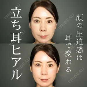 BIANCA銀座 明石 仙姫医師の症例