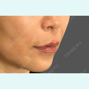 Wi Clinic（ウィ クリニック） 大宮院の症例