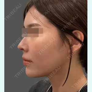 Wi Clinic（ウィ クリニック） 大宮院の症例