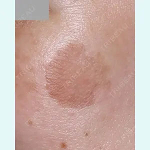 Wi Clinic（ウィ クリニック） 大宮院の症例