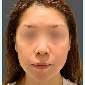 Wi Clinic（ウィ クリニック） 大宮院の症例