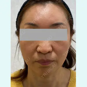 Wi Clinic（ウィ クリニック） 大宮院の症例