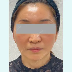 Wi Clinic（ウィ クリニック） 大宮院の症例