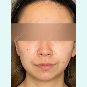 Wi Clinic（ウィ クリニック） 銀座院の症例